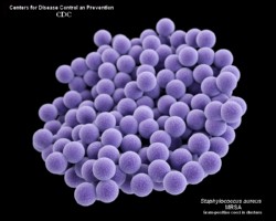 3D model of a cluster of MRSA bacteria